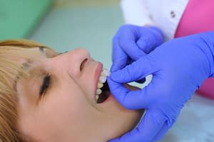 dentist placing veneers on a smiling dental patient